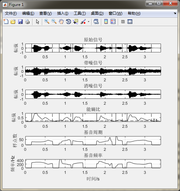 《MATLAB语音信号分析与合成（第二版）》：第8章 基音周期的估算方法
