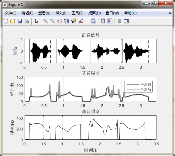 《MATLAB语音信号分析与合成（第二版）》：第8章 基音周期的估算方法