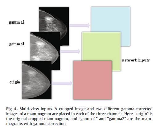 ＜论文阅读07＞ 用于乳房 X 线照片分类的具有多个视图的多示例网络